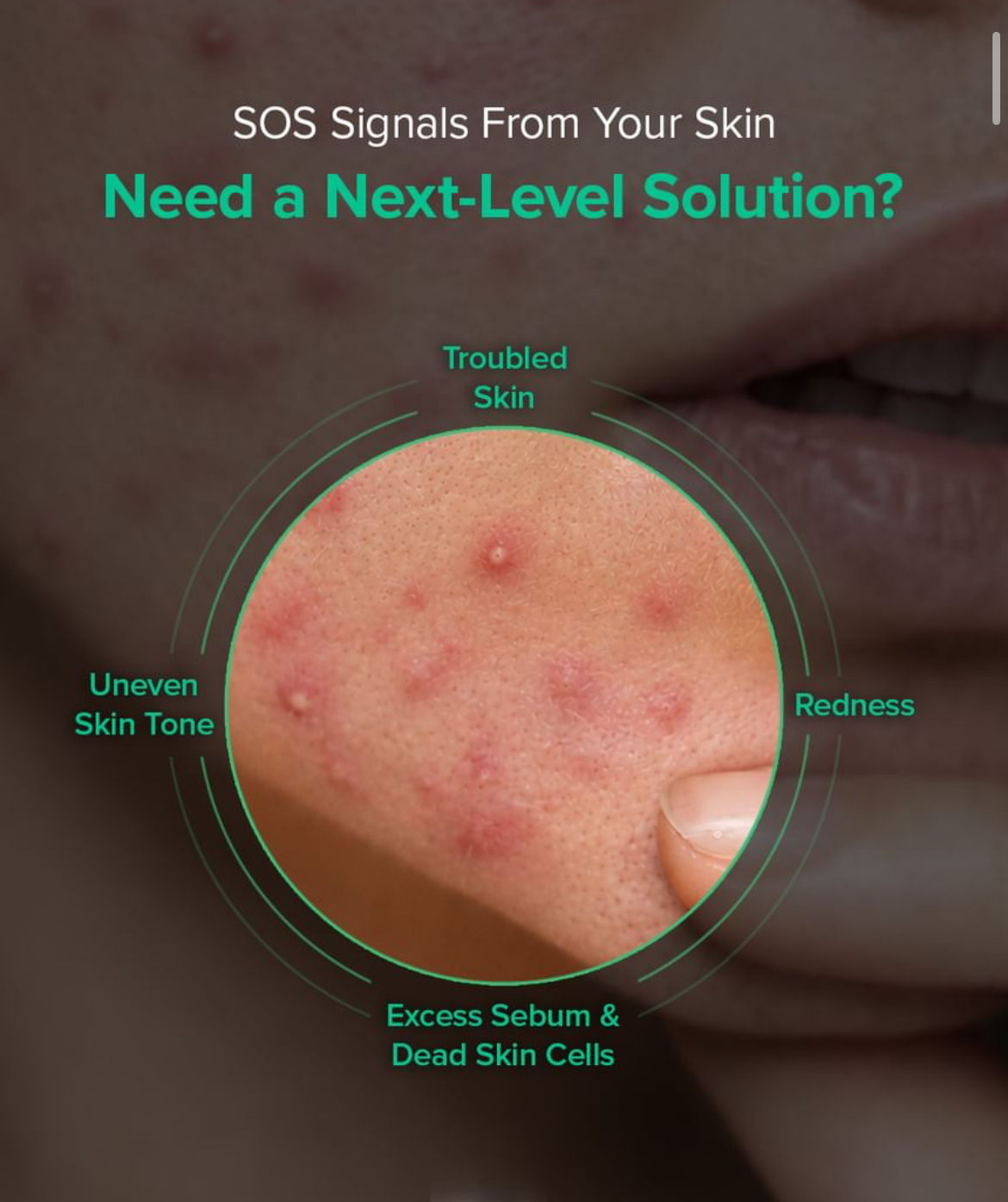 MARY & MAY Spicule Azelaic PDRN Spot Cream