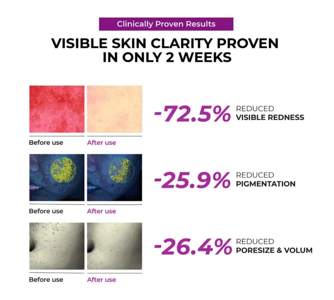 JUMISO Niacinamide 10 Serum