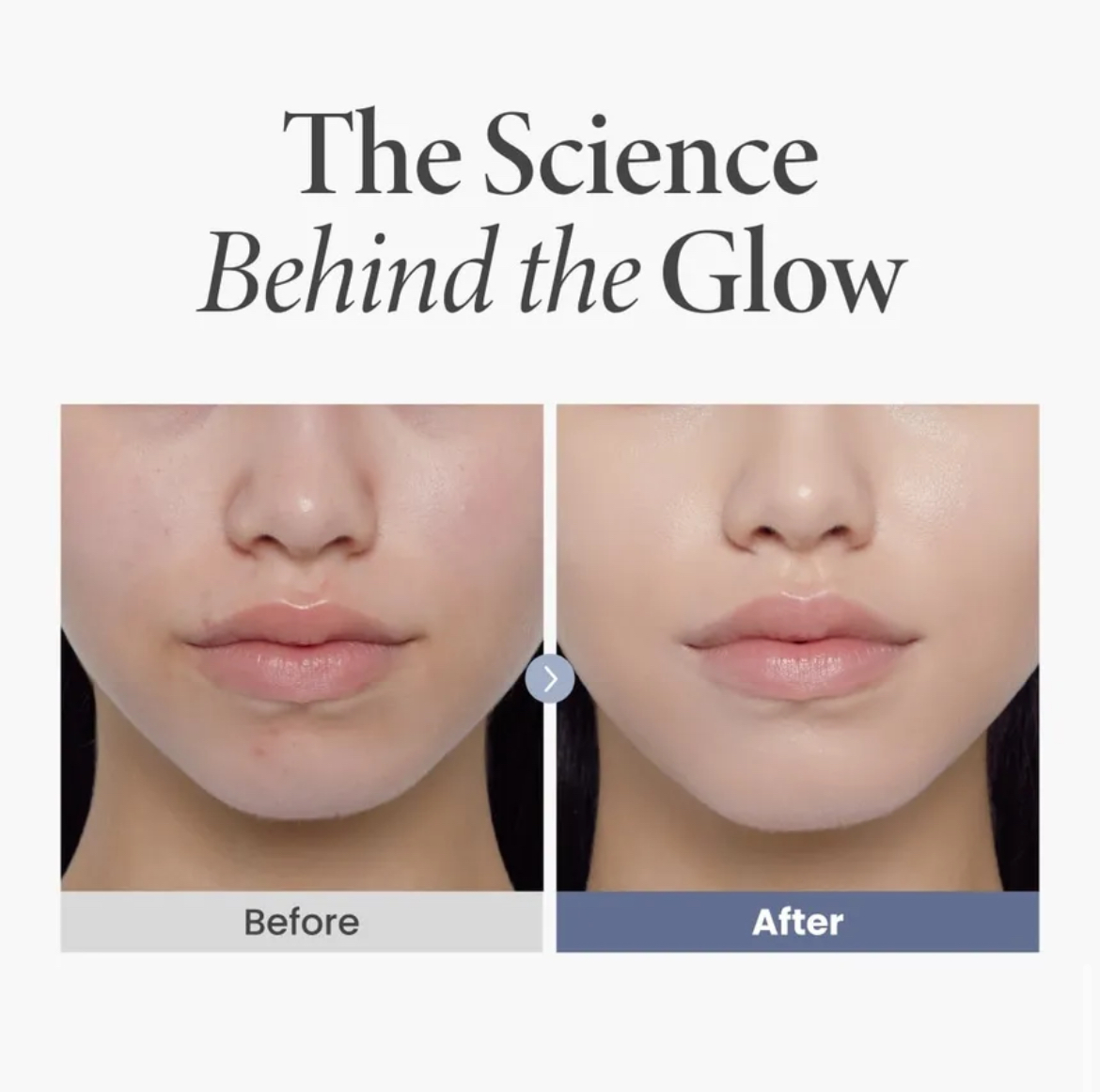 AXIS-Y TXA 2.5% Intensive Brightening Cream