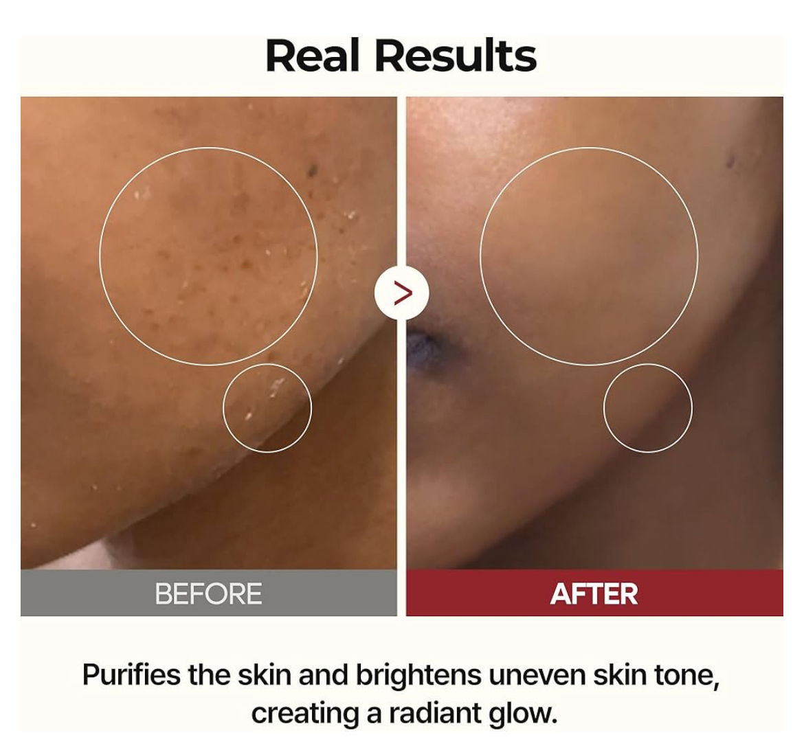 Dr. Melaxin Peel Shot PS Glow White Rice Toner