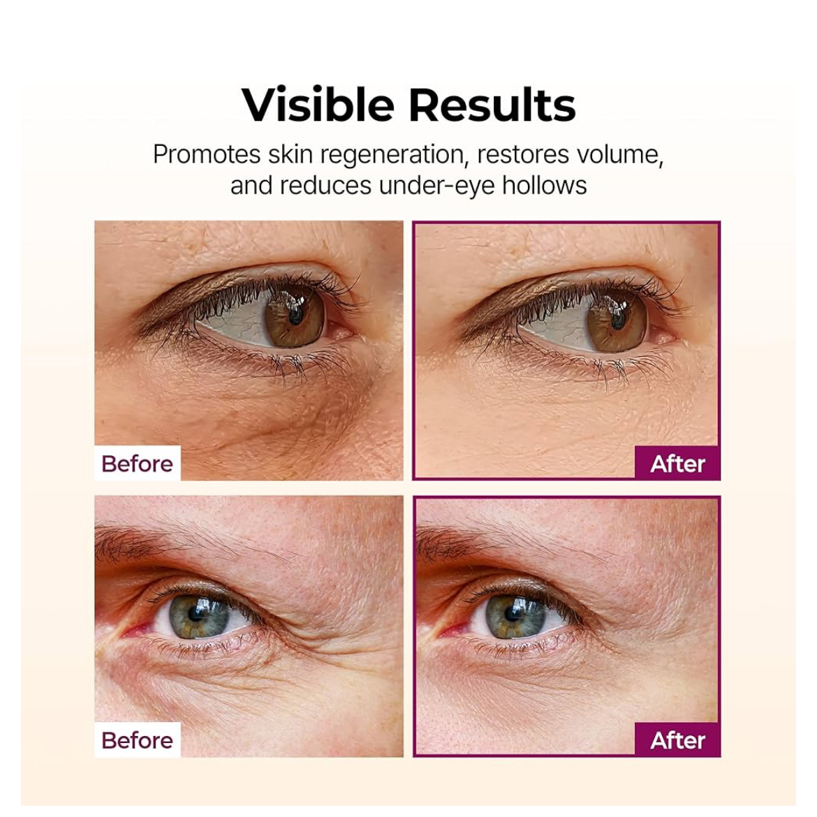Dr.Melaxin Cemenrete Calcium Volume Multi Balm