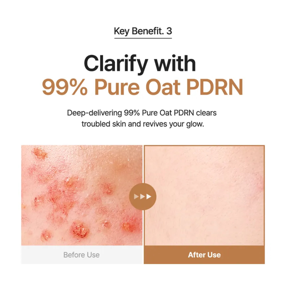 Purito Oat PDRN Gentle Refining Toner