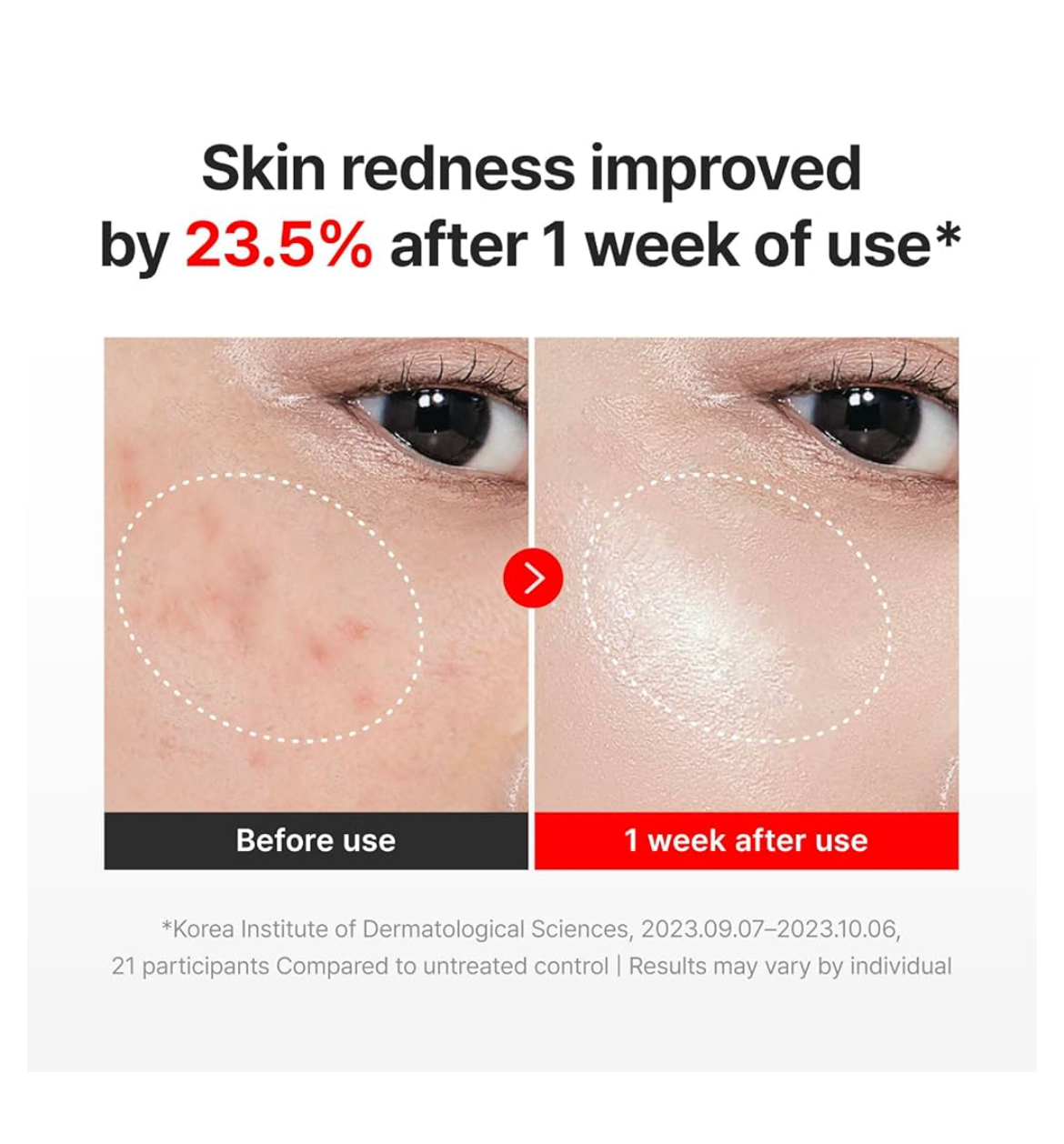 Centellian24 Cream
