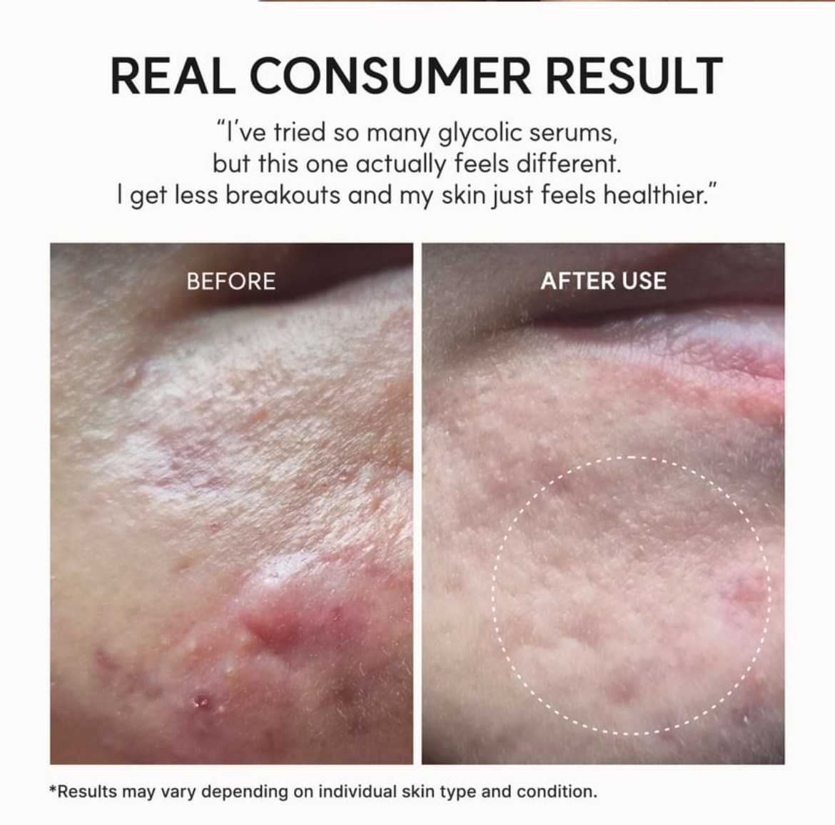 Arencia Fresh Rosehip Booster Shot
