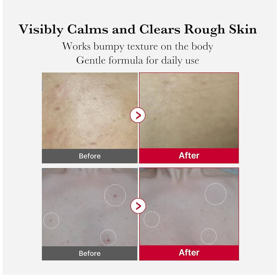 Medicube Red Body Peeling Shot