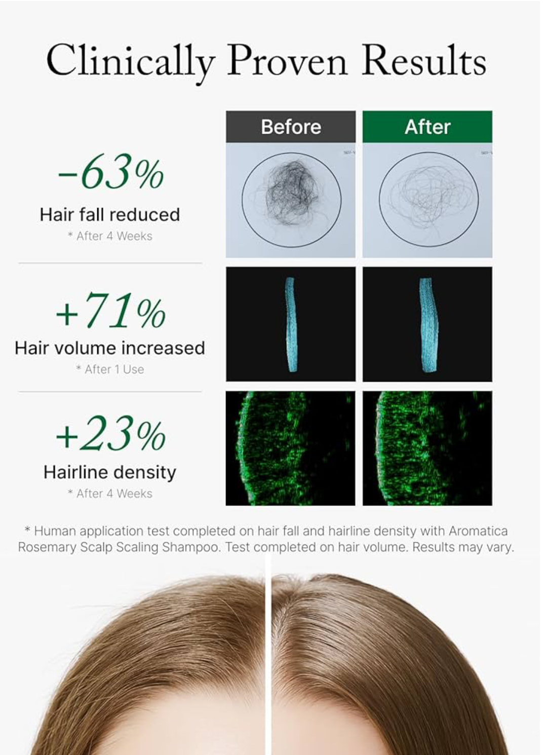 Aromatica Rosemary Scalp Scaling Shampoo