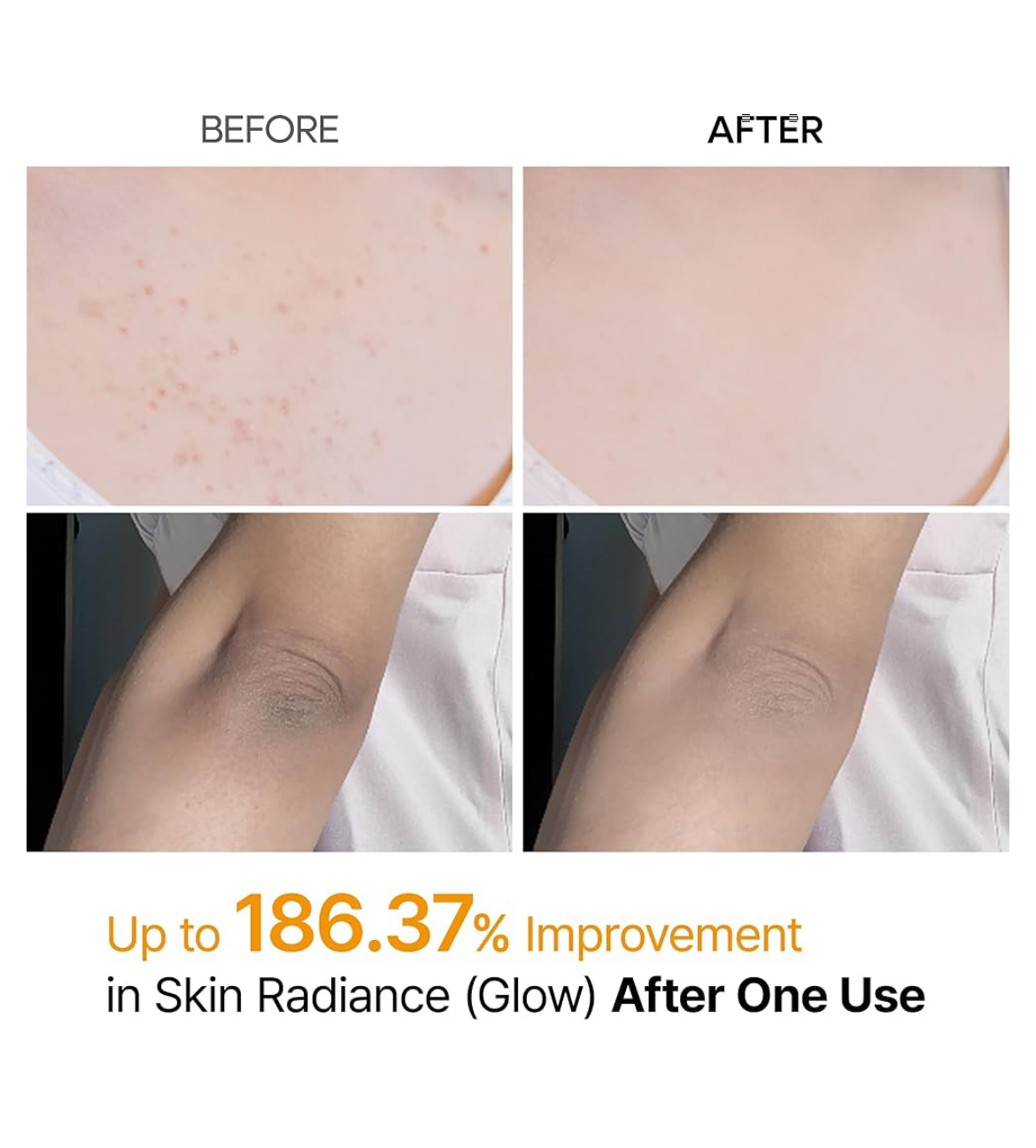 Dr.Melaxin Peel Shot Exfoliating Kojic Acid Turmeric Spray