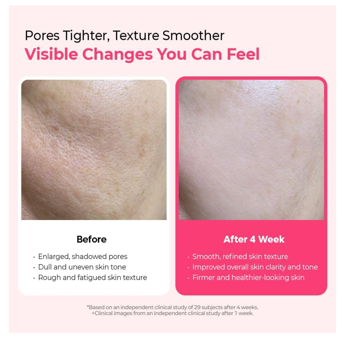 Dr.Melaxin - Cemenrete Cyano Pink Spicule Serum